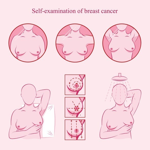 Self-examination to detect breast cancer