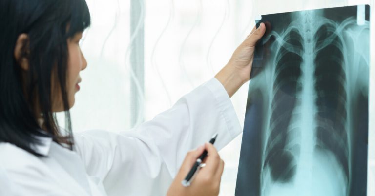 Lung cancer diagnosis